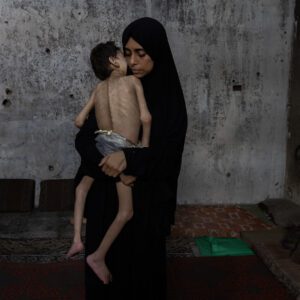 الجوع في غزة يقتل الجميع